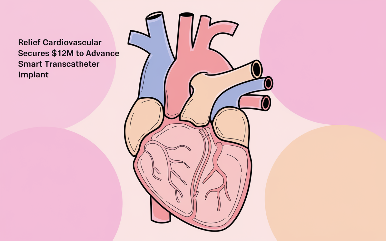 Relief Cardiovascular Secures $12M to Advance Smart Transcatheter Implant